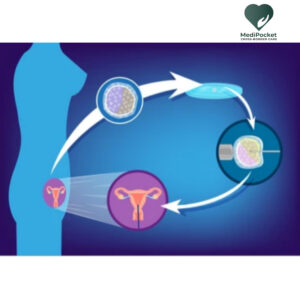 surrogacy procedure