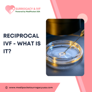 Reciprocal IVF – what is it?